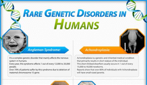 famous people with genetic disorders.